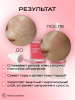 Осветляющая сыворотка с транексамовой кислотой Anua Niacinamide 10% + TXA 4% Serum 30 мл | Москосметикс