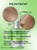 Сыворотка с азелаиновой кислотой Anua Azelaic Acid 10 Hyaluron Redness Soothing Serum 30 мл | Москосметикс